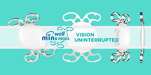 Mini Well lente intraocular tórica precargada para mini-incisión conocida en algunos mercados como EDOF multifocal. Para presbicia y cataratas.
